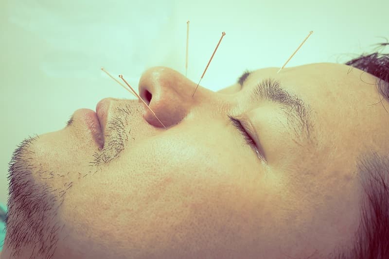 agujas-acupuntura-tratamiento-medicinas-alternativas