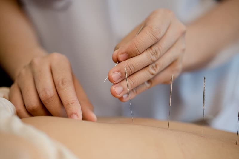 tratamiento acupuntura medicinas alternativas